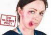 “Merseyside police & CPS let off student who viciously attacked a female Ambulance Technician, fracturing her cheek bone.”