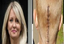 21 year old with brain tumours declared ‘Fit for Work’ by Department of Work & Pensions