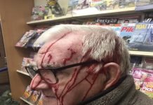 73 year old man attacked by two thugs with machetes in Wigan