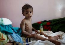 Yemen in danger of big famine – NO PROFIT IN PEACE! Yemen